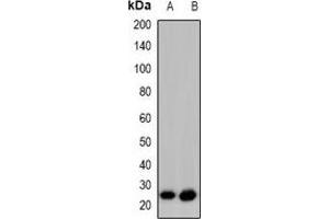 Western blot analysis of GAP43 (pS41) expression in HeLa PMA-treated (A), SHSY5Y (B) whole cell lysates. (GAP43 antibody  (N-Term, pSer41))