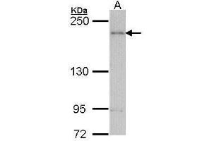 WB Image Sample (30 ug of whole cell lysate) A: H1299 5% SDS PAGE antibody diluted at 1:1000 (ARAP1 antibody  (C-Term))