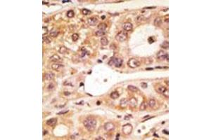 Image no. 1 for anti-Toll-Like Receptor 5 (TLR5) (C-Term) antibody (ABIN357052)