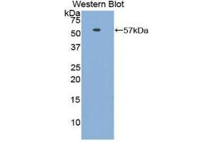 Western Blotting (WB) image for anti-HSPA Binding Protein, Cytoplasmic Cochaperone 1 (HSPBP1) (AA 136-354) antibody (ABIN1176143)