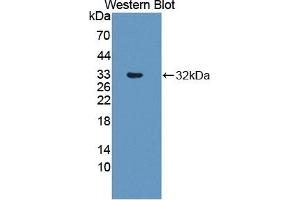 Detection of Recombinant RSPO3, Human using Polyclonal Antibody to R-Spondin 3 (RSPO3) (R-Spondin 3 antibody  (AA 22-272))