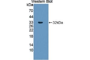 Detection of Recombinant RSPO3, Human using Polyclonal Antibody to R-Spondin 3 (RSPO3)