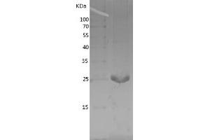 Western Blotting (WB) image for Aprataxin (APTX) (AA 180-356) protein (His tag) (ABIN7281954) (Aprataxin Protein (APTX) (AA 180-356) (His tag))