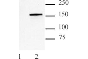 Cas9 antibody (mAb) tested by Western blot. (CRISPR-Cas9 (N-Term) antibody)