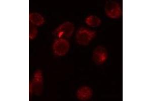 ABIN6276580 staining Hela by IF/ICC. (EpCAM antibody  (Internal Region))