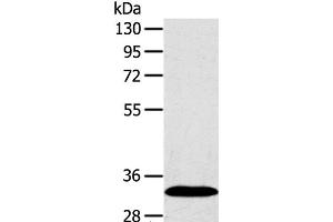 Western Blot analysis of Human fetal liver tissue using SULT2A1 Polyclonal Antibody at dilution of 1:650 (SULT2A1 antibody)