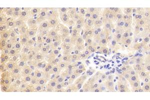 Detection of PLA2G3 in Rat Liver Tissue using Polyclonal Antibody to Phospholipase A2, Group III (PLA2G3) (PLA2G3 antibody  (AA 20-268))