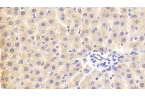 Detection of PLA2G3 in Rat Liver Tissue using Polyclonal Antibody to Phospholipase A2, Group III (PLA2G3) (PLA2G3 antibody  (AA 20-268))