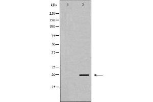 Western blot analysis of Myosin regulatory light chain 2 (Phospho-Ser18) expression in K562 cell extract.
