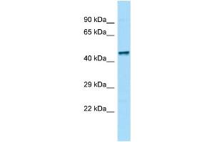 WB Suggested Anti-Zfp69 Antibody Titration: 1. (ZFP69 antibody  (C-Term))