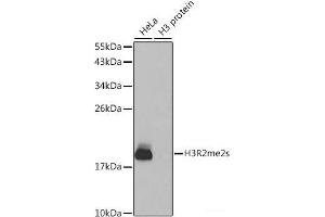Western blot analysis of extracts of various cell lines using Symmetric DiMethyl-Histone H3-R2 Polyclonal Antibody. (Histone 3 antibody  (H3R2me2s))