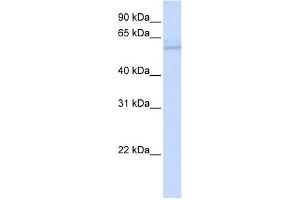 ND5 antibody used at 1 ug/ml to detect target protein. (MT-ND5 antibody)