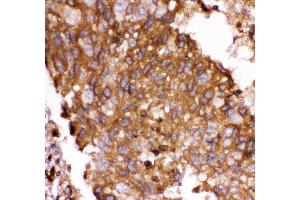 Immunohistochemistry (IHC) image for anti-Forkhead Box O3 (FOXO3) (AA 471-673) antibody (ABIN3042404)