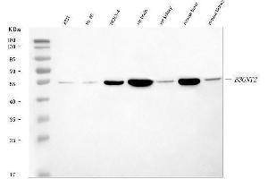 Western blot analysis of B3GNT2 using anti-B3GNT2 antibody (ABIN7602134).