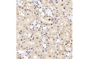 Immunohistochemistry (Paraffin-embedded Sections) (IHC (p)) image for anti-Ubiquitin Protein Ligase E3A (ube3a) antibody (ABIN7076105)