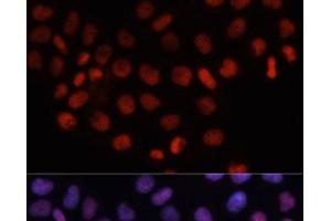Immunofluorescence analysis of HeLa cells using RCC1 Polyclonal Antibody at dilution of 1:100. (RCC1 antibody)