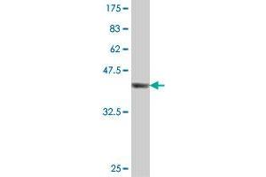 Western Blot detection against Immunogen (37. (DAZ1 antibody  (AA 21-120))