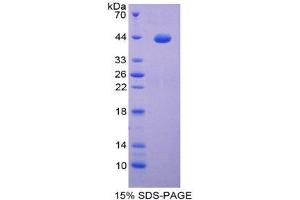 SDS-PAGE (SDS) image for S100 Protein (S100) (AA 1-94) protein (His tag,GST tag) (ABIN2123566) (S100 Protein (S100) (AA 1-94) protein (His tag,GST tag))