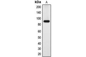 Western blot analysis of DYRK1A expression in HeLa (A) whole cell lysates. (DYRK1A antibody  (N-Term))
