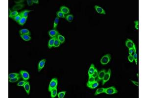 Immunofluorescent analysis of HepG2 cells using ABIN7163181 at dilution of 1:100 and Alexa Fluor 488-congugated AffiniPure Goat Anti-Rabbit IgG(H+L) (PREX2 antibody  (AA 1417-1592))