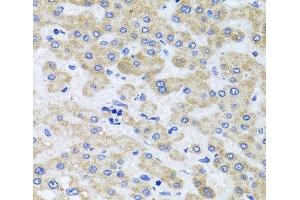 Immunohistochemistry of paraffin-embedded Human liver damage using PEX3 Polyclonal Antibody at dilution of 1:100 (40x lens). (PEX3 antibody)