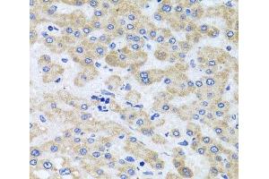 Immunohistochemistry of paraffin-embedded Human liver damage using PEX3 Polyclonal Antibody at dilution of 1:100 (40x lens).