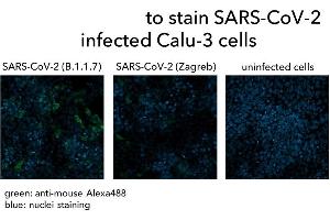 Calu-3 cells were infected with SARS-CoV-2 (B. (Recombinant SARS-CoV-2 Spike antibody  (AA 319-541))
