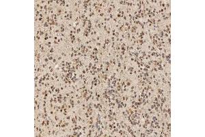 IHC analysis of SNRNP40 using anti-SNRNP40 antibody (ABIN7601719).