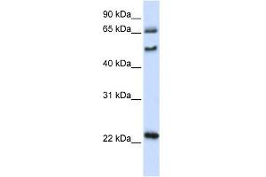 WB Suggested Anti-UNCX Antibody Titration:  0. (UNCX antibody  (N-Term))