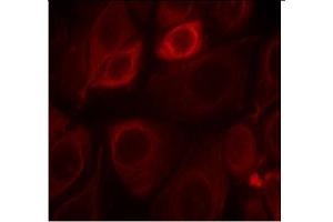 Image no. 1 for anti-Receptor Tyrosine-Protein Kinase ErbB-3 (ERBB3) (pTyr1328) antibody (ABIN319274) (ERBB3 antibody  (pTyr1328))