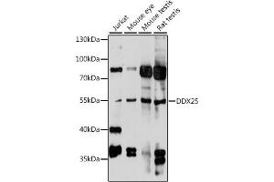 Western blot analysis of extracts of various cell lines, using DDX25 antibody (ABIN7266692) at 1:1000 dilution. (DDX25 antibody  (AA 284-483))