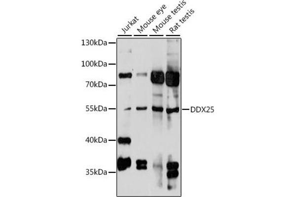 DDX25 Antikörper  (AA 284-483)