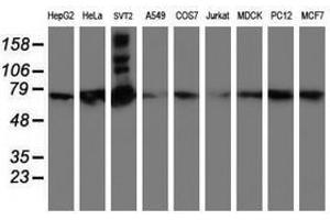 Image no. 2 for anti-SAM Domain and HD Domain 1 (SAMHD1) antibody (ABIN1500798) (SAMHD1 antibody)