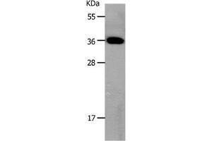 Gel: 10 % SDS-PAGE Lysates (from left to right): Mouse large intestine tissue Amount of lysate: 30 μg per lane Primary antibody: 1/800 dilution Secondary antibody dilution: 1/8000 Exposure time: 20 seconds (MC3R antibody  (N-Term))