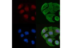 ABIN6264342 and ABIN6277090 staining Hela cells by IF/ICC. (POLR2A/RPB1 antibody  (Internal Region))