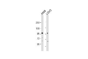 All lanes : Anti-EPS8 Antibody (N-term) at 1:2000 dilution Lane 1: A549 whole cell lysate Lane 2: LOVO whole cell lysate Lysates/proteins at 20 μg per lane.