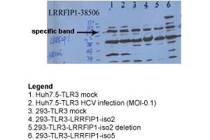 Sample Type: Hepatitis C Virus & 293 TransfectionsPrimary Dilution: 1ug/mL (LRRFIP1 antibody  (N-Term))