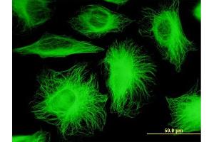 Immunofluorescence of monoclonal antibody to TUBB2A on HeLa cell. (TUBB2A antibody  (AA 1-445))