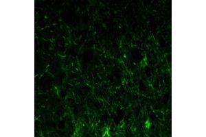 Immunofluorescence analysis of paraffin-embedded lobe of brain tissues using GFAP mouse mAb (green). (GFAP antibody)