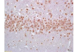 Formalin-fixed and paraffin embedded rat brain labeled with Anti-FGGY Polyclonal Antibody, Unconjugated (ABIN1387445) at 1:200 followed by conjugation to the secondary antibody and DAB staining (FGGY antibody  (AA 151-250))