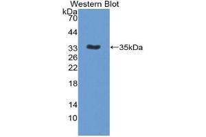 Western blot analysis of the recombinant protein. (IL12B antibody  (AA 35-302))
