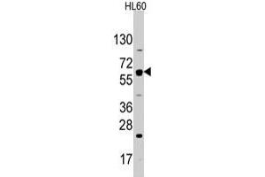 Western blot analysis of SLC2A2 polyclonal antibody  in HL-60 cell line lysates (35 ug/lane).
