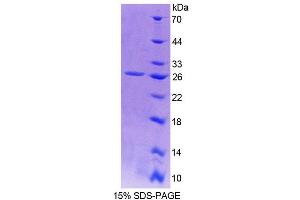SDS-PAGE analysis of Human Sp17 Protein.