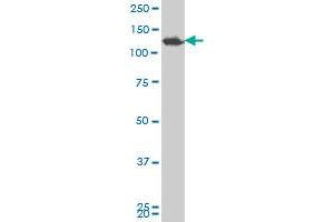 SMARCA5 polyclonal antibody (A01), Lot # 051018JC01 Western Blot analysis of SMARCA5 expression in Y-79 . (SMARCA5 antibody  (AA 59-147))