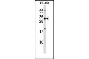 Western blot analysis of HOXB8 / HOX2D Antibody (C-term) in HL-60 cell line lysates (35ug/lane). (HOXB8 antibody  (C-Term))