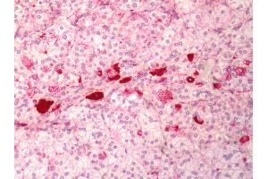 Human Adrenal: Formalin-Fixed, Paraffin-Embedded (FFPE) (MC1 Receptor antibody  (Cytoplasmic Domain))