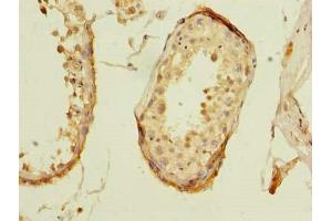 Immunohistochemistry of paraffin-embedded human testis tissue using ABIN7176433 at dilution of 1:100 (ZNF614 antibody  (AA 1-198))