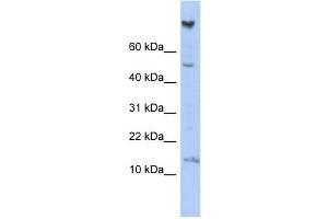WB Suggested Anti-NRARP Antibody Titration: 0. (NRARP antibody  (Middle Region))