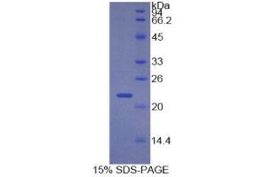 SDS-PAGE (SDS) image for Cyclin-Dependent Kinase Inhibitor 1A (p21, Cip1) (CDKN1A) (AA 1-164) protein (His tag) (ABIN1821738)