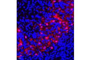 Immunofluorescence (Paraffin-embedded Sections) (IF (p)) image for anti-Linker For Activation of T Cells Family, Member 2 (LAT2) antibody (ABIN7074503)